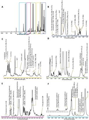 Lipid profiling of RON and DEK-dependent signaling in breast cancer guides discovery of gene networks predictive of poor outcomes